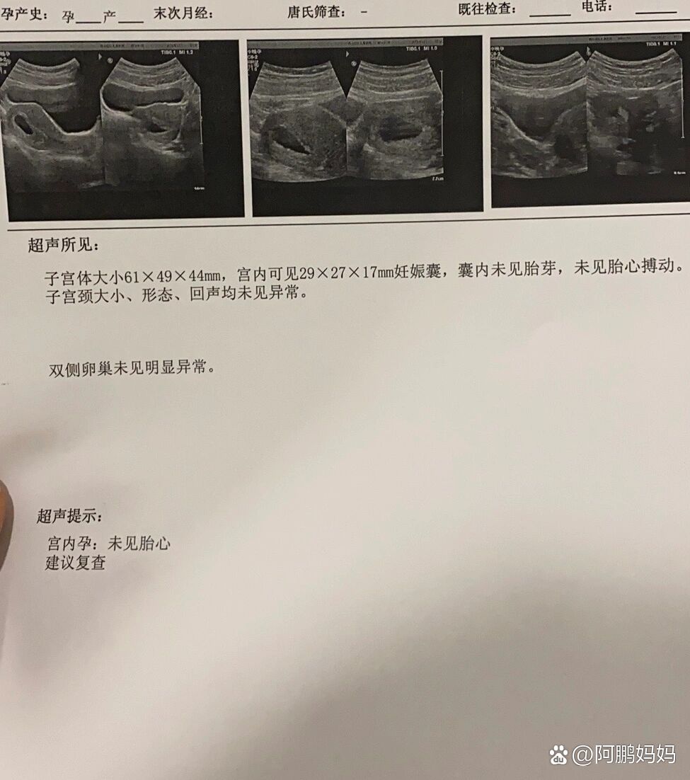 分享实测“有没有优乐字牌可以装挂吗	”分享用挂教程-第2张图片