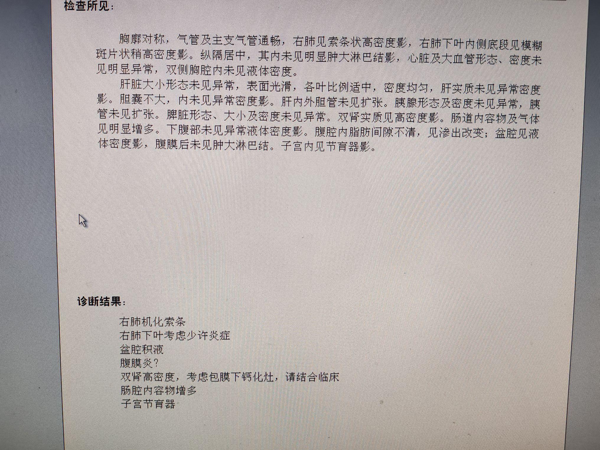 【喀什或现三代病例/喀什现有病例】-第2张图片